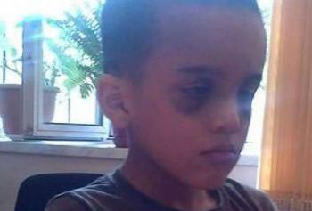 7-летний Махир избит одной из своих учительниц за непослушание
